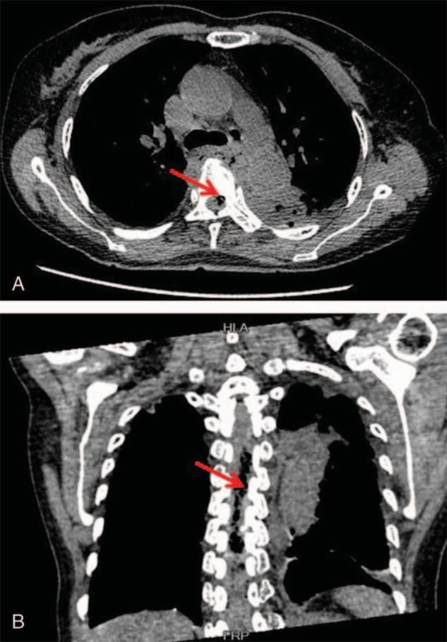 补硒对甲状腺有用吗（补甲状腺硒用有什么功效）-硒宝网