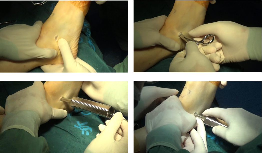 补硒对甲状腺有用吗（补甲状腺硒用有什么功效）-硒宝网