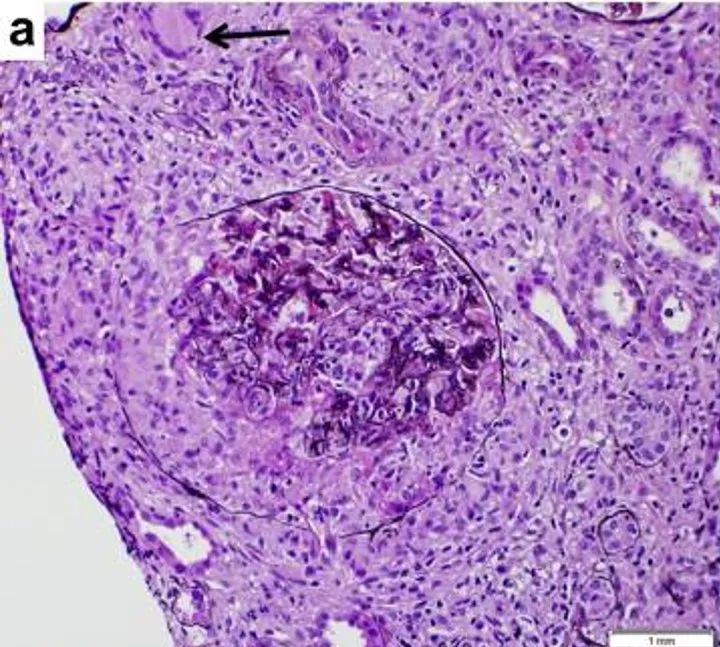儿童补硒有副作用没(儿童补硒的药物哪种最好)-硒宝网