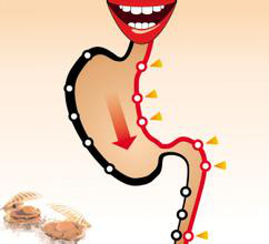 胃癌切除后要补硒吗(胃癌吃硒片有效果吗)-硒宝网