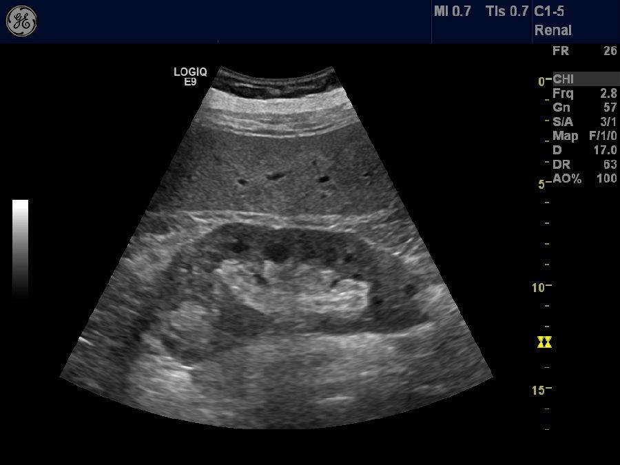 为什么要持续补硒呢（补硒要吃几个月）-硒宝网