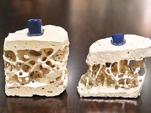 30岁需要补钙吗(补钙需要停一段时间吗)-硒宝网