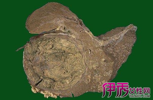 2005年科学补硒(科学补硒势在必行)-硒宝网