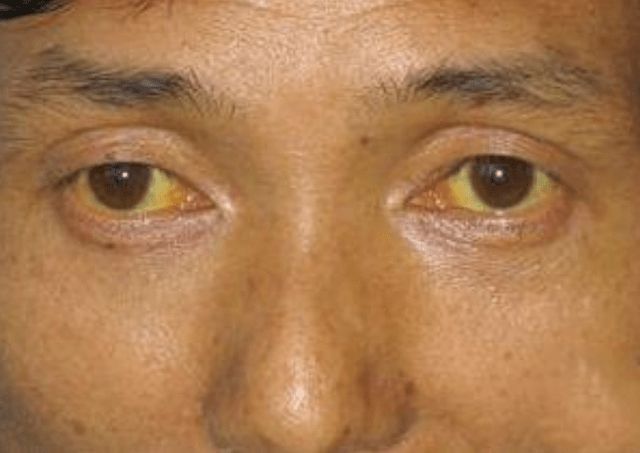 2005年科学补硒(科学补硒势在必行)-硒宝网