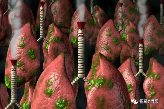 肺癌病人补硒有效吗(肺癌患者补硒有什么好处有用吗)-硒宝网