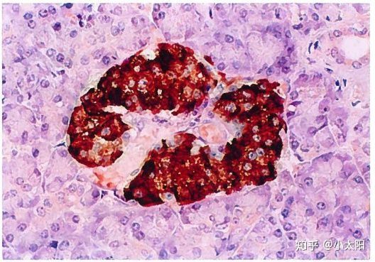 皮肤病人需要补硒吗（病人补皮肤需要硒含量多少）-硒宝网