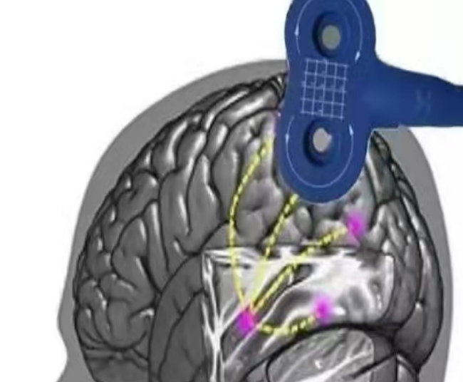 补硒对睡眠有改善没（补硒失眠）-硒宝网