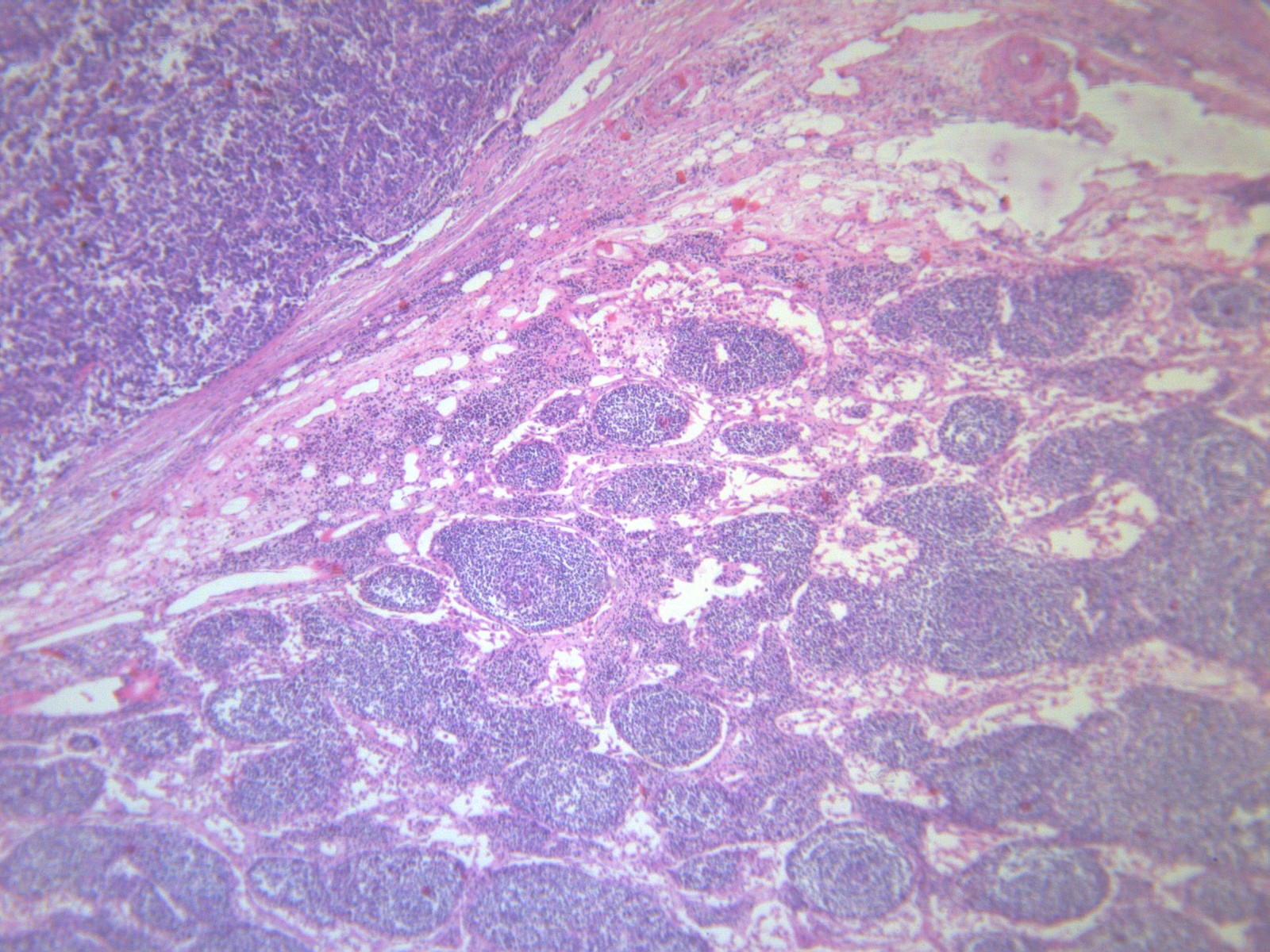 胆管癌病人怎样补硒(胆管癌喝什么营养粉)-硒宝网