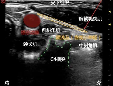 钠怎么补(钠补液量计算公式)-硒宝网