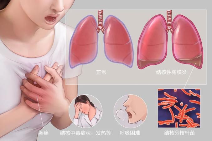 补硒后大便会变黑吗(服用硒酵母大便黑色)-硒宝网