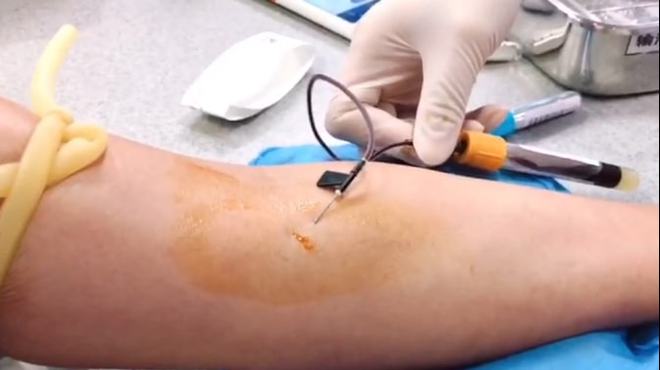 输液补钙一般需要几天(输液补钙天一般需要多少钱)-硒宝网