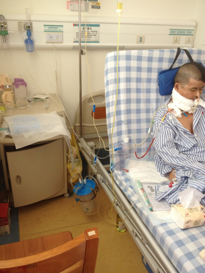 胰腺放疗后能补硒嘛（硒对胰腺癌有效果吗）-硒宝网