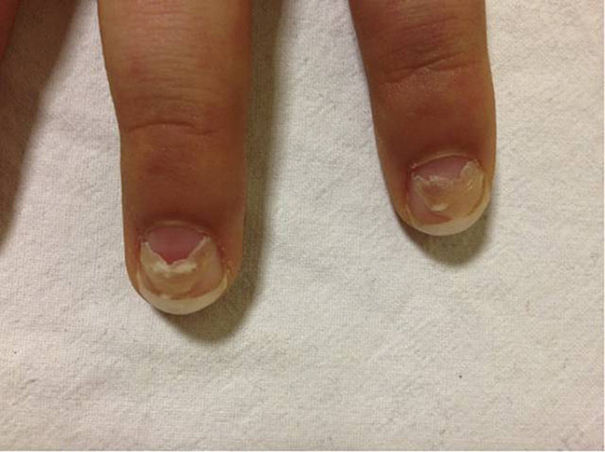 可补硒的食物有哪些(补食物硒可有副作用吗)-硒宝网