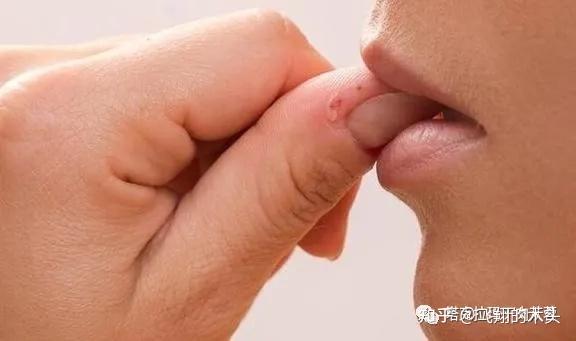 咬指甲缺什么微量元素(咬指甲是缺微量元素吗)-硒宝网