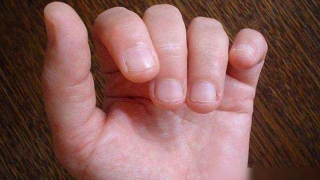 咬指甲缺什么微量元素(指甲缺乏微量元素)-硒宝网