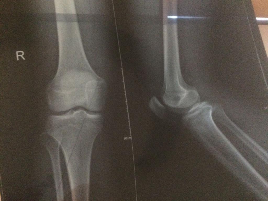 小孩检查微量元素要多少钱（微量元素检查需要抽血么儿童）-硒宝网