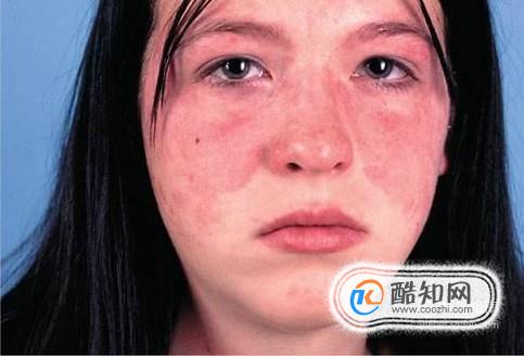 微量元素 铅(铅微量元素是什么)-硒宝网