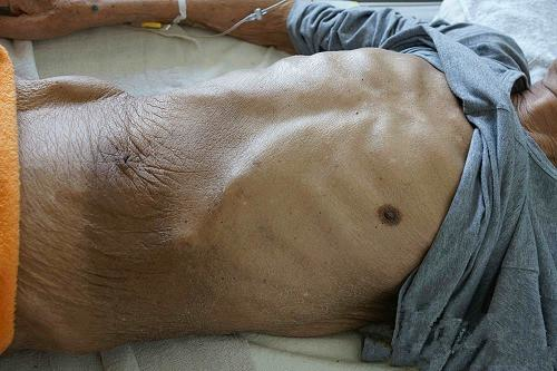 补硒对睡眠有帮助吗(补硒改善睡眠)-硒宝网