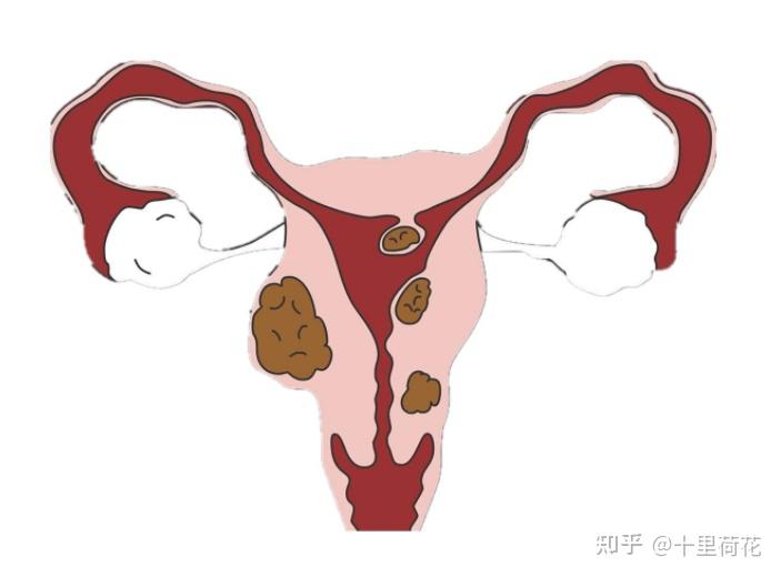 宫颈癌每天补硒多少（宫颈癌补硒有用吗）-硒宝网