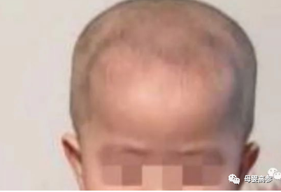 感冒期间可以补钙吗（感冒期间能补钙）-硒宝网