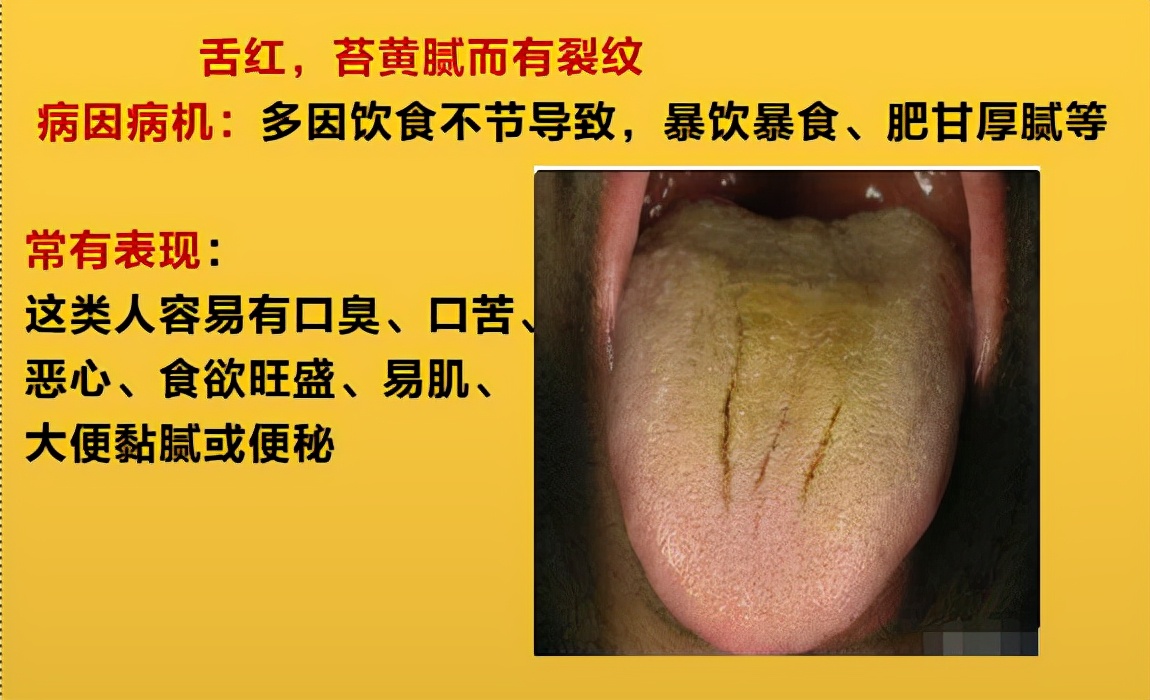 有胃病的可以补硒吗(胃病几年了吃硒治好胃病了)-硒宝网