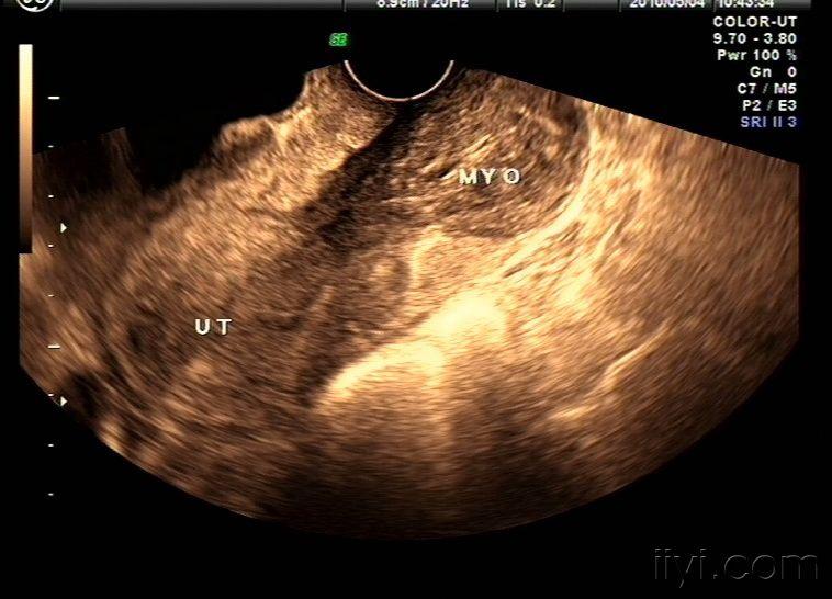 治疗宫颈炎补硒用量(宫颈炎光塞药能好吗)-硒宝网