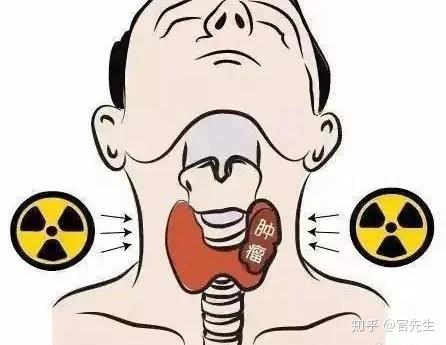 碘元素是什么(碘元素是什么食物)-硒宝网