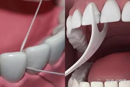 补硒治疗口腔溃疡吗(硒对口腔溃疡有没有好处)-硒宝网