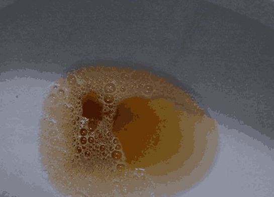 静脉补钠(静脉补钠的五个原则)-硒宝网