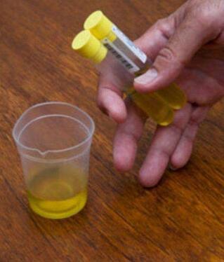 静脉补钠(静脉补钠的五个原则)-硒宝网