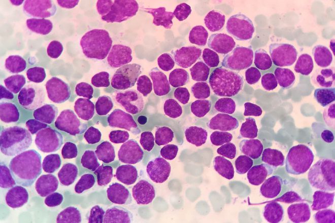 补铁好处(补铁好处)-硒宝网