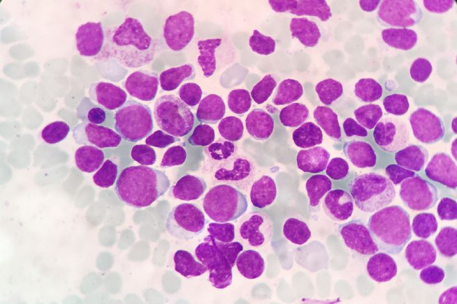 补铁好处(补铁好处)-硒宝网