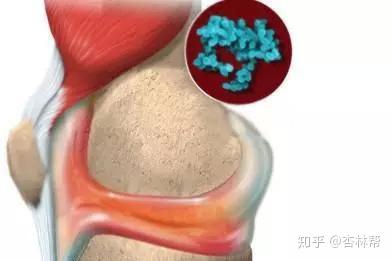 生长痛要补钙吗(生长痛补钙后还会痛吗)-硒宝网