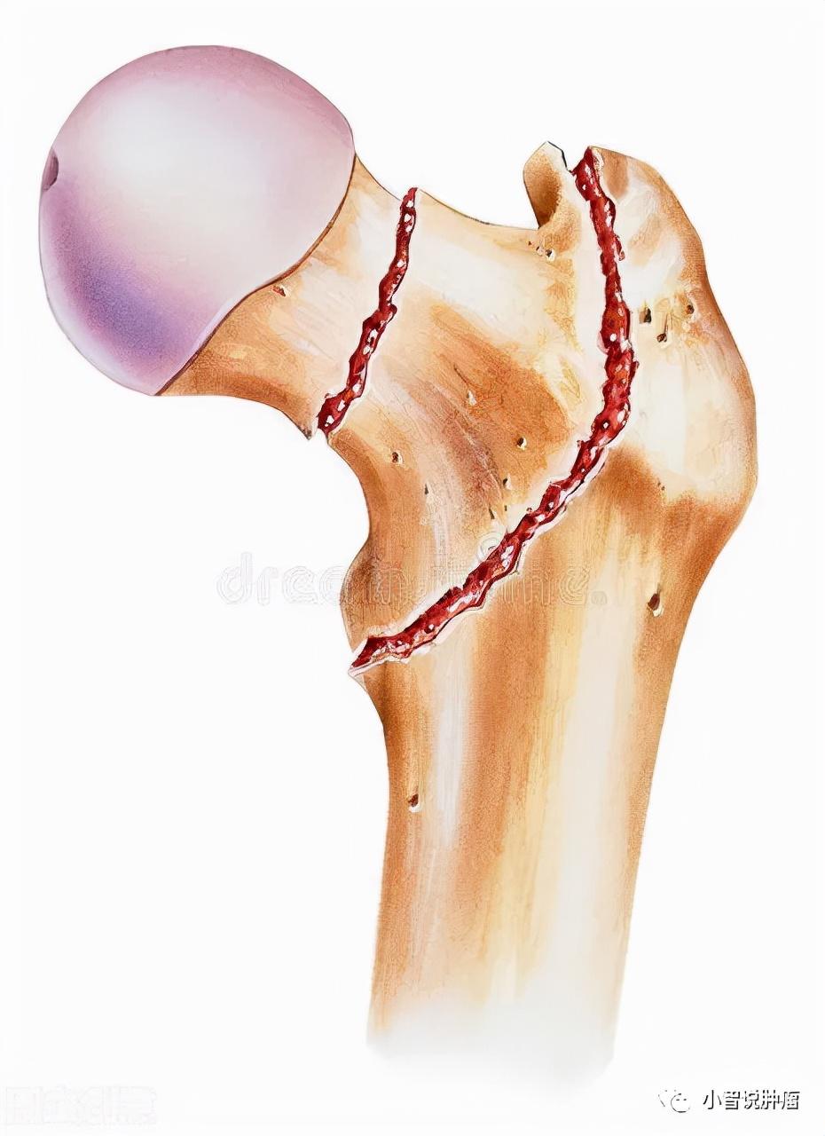 什么人群需要补钙(需要补钙的人)-硒宝网
