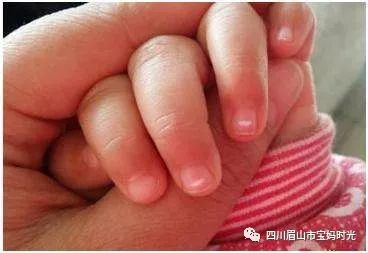 荷兰补硒保健品推荐（荷兰保健品）-硒宝网