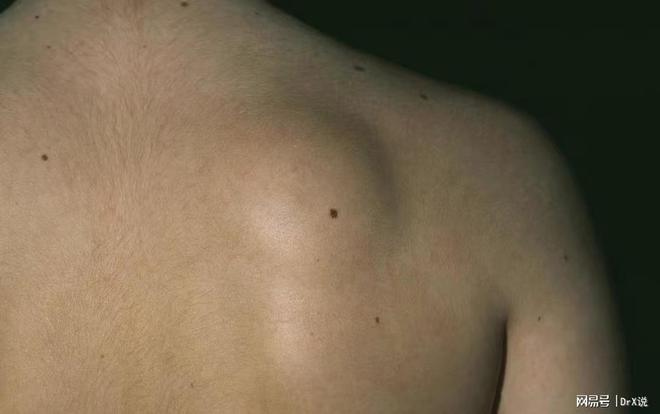 免疫治疗可以补硒吗(免疫补治疗硒可以吃多久)-硒宝网