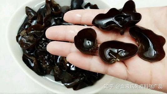 什么食物能补铁(食物补铁的最佳选择是)-硒宝网