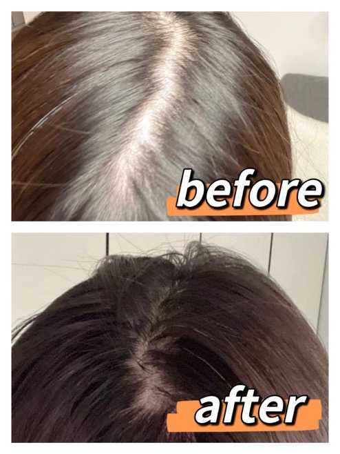 怎么能最快补硒元素(硒元素能随便补吗)-硒宝网