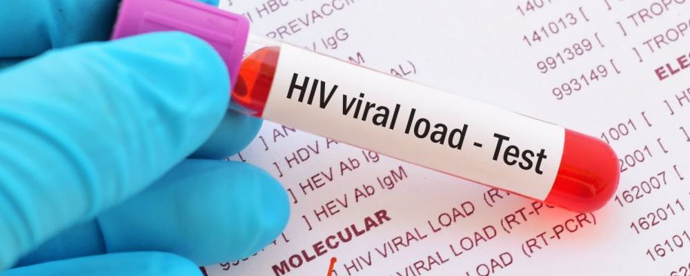 补硒治疗艾滋病案例(艾滋病人补硒)-硒宝网