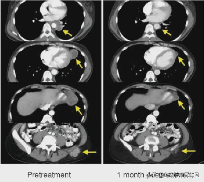 白细胞低可补哪种硒(细胞补种低白硒可以补充吗)-硒宝网