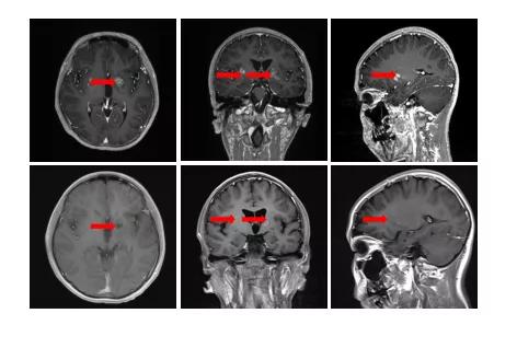 白细胞低可补哪种硒(细胞补种低白硒可以补充吗)-硒宝网