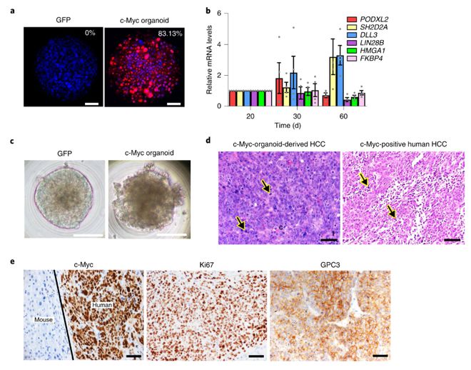 肝癌病人可以补硒吗(肝癌能补硒吗)-硒宝网