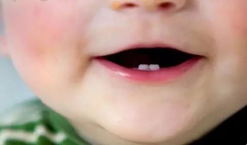 宝宝长牙需要补钙吗(宝宝长牙期补钙)-硒宝网