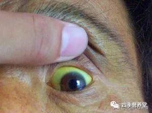 补硒有利于静脉扩张（扩张静脉的药）-硒宝网