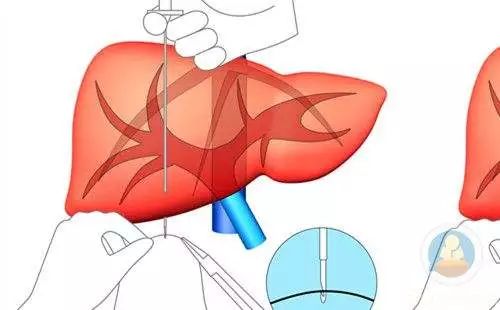 补硒有利于静脉扩张（静脉扩张剂有哪些）-硒宝网