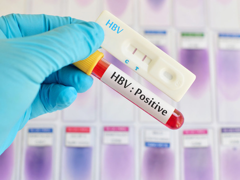 补铁的药品(药品补铁和保健品补铁哪个好)-硒宝网