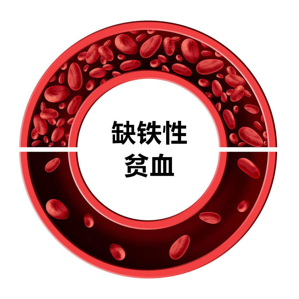 孩子补铁吃什么药(药吃孩子补铁可以吗)-硒宝网