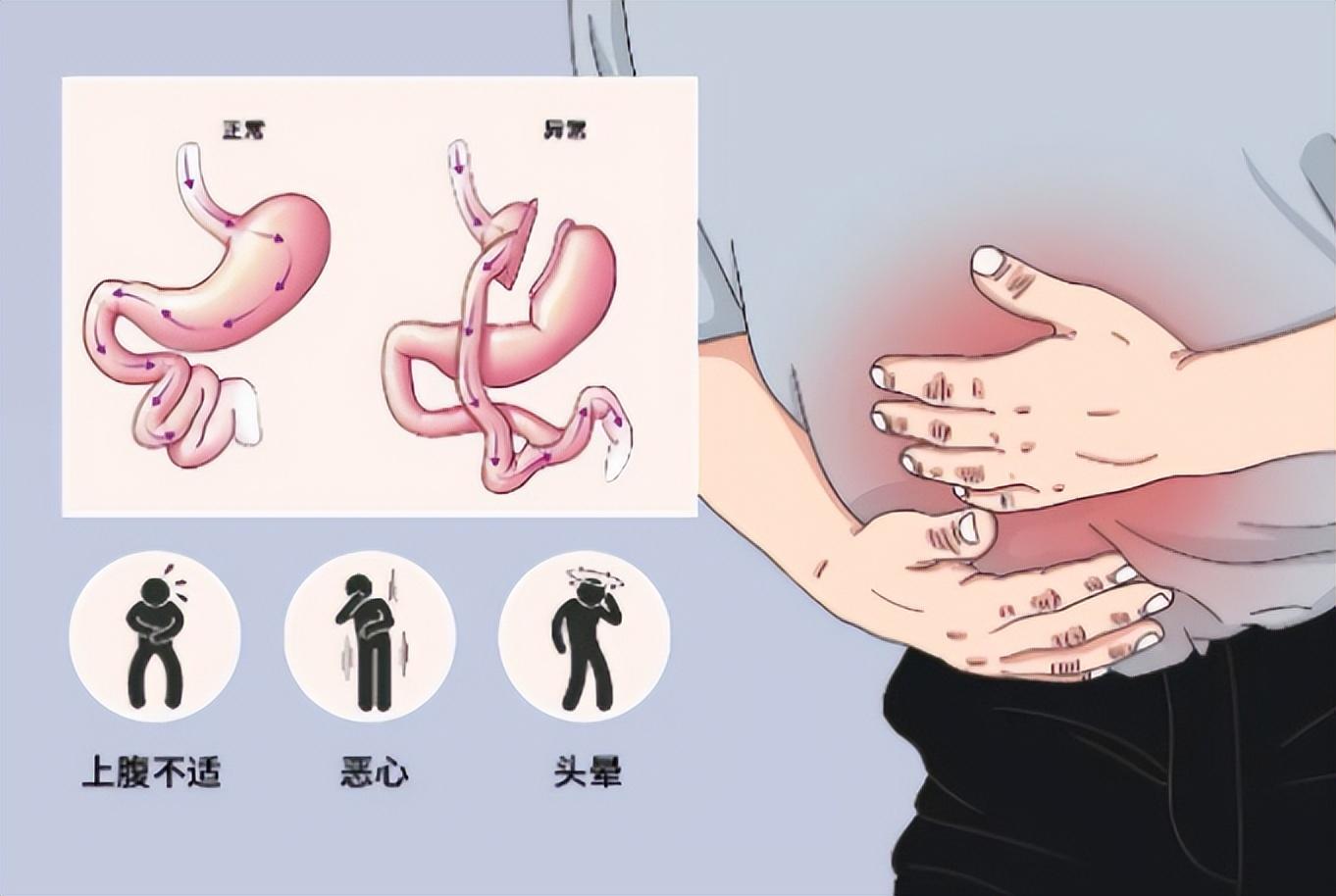胃部手术后能补硒吗(胃部手术后能吃西洋参吗)-硒宝网