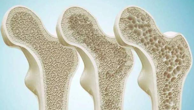 虾皮是补钙的吗（虾皮补钙好还是钙片补钙好）-硒宝网