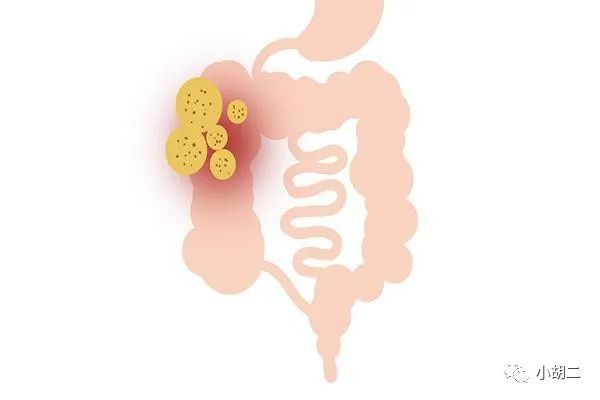 提高免疫力补硒推荐（提高免疫力补硒有用吗）-硒宝网
